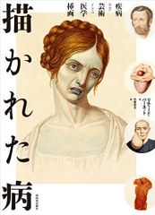『描かれた病:疾病および芸術としての医学挿画』